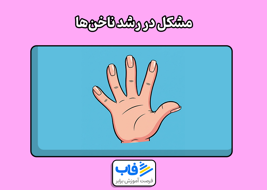 مشکل در رشد ناخن‌ها
